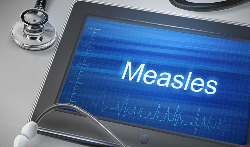 Measles: What You Need to Know
