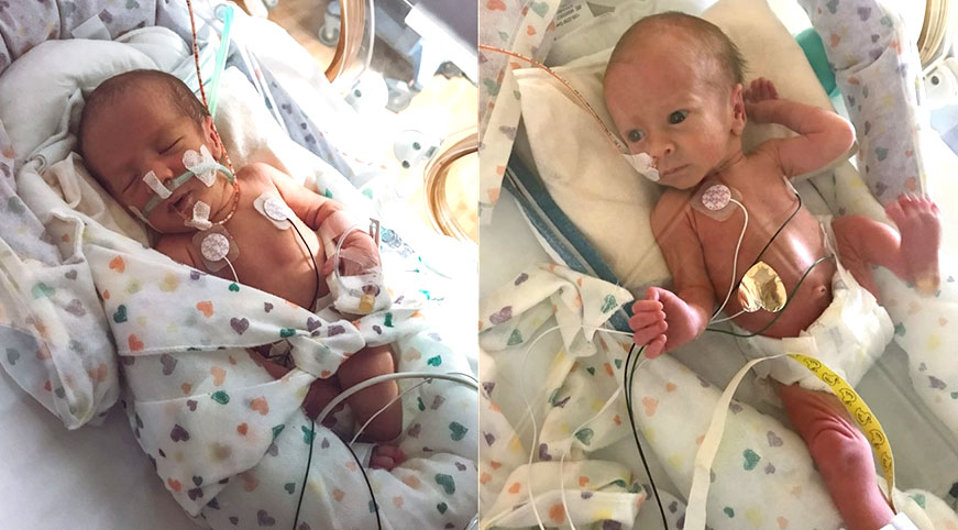Preemie Twin Babies Receive Life-Saving Care